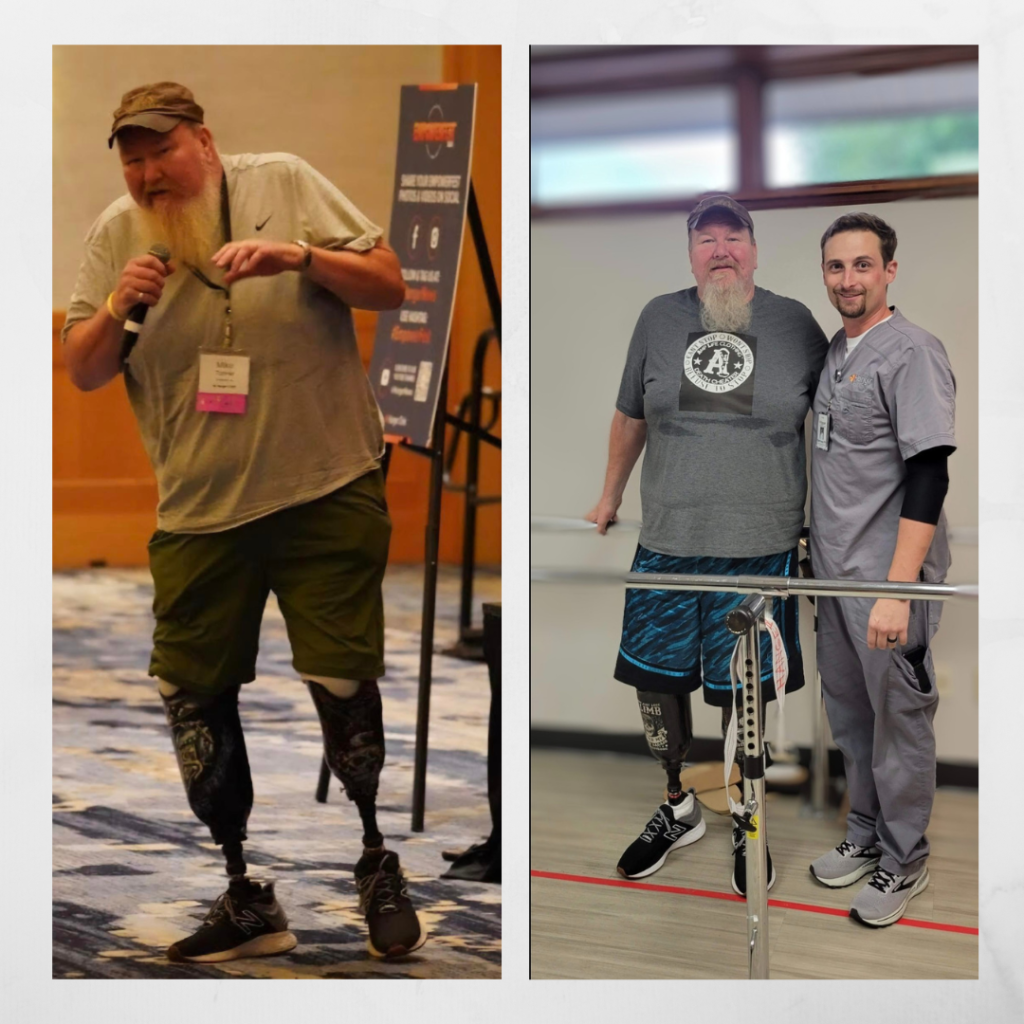 Mike Tanner, a double amputee, stands with his prosthetics in two images, one by himself, the other with a prosthetics support person in grey scrubs.